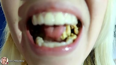 Retainer Candy Apple Eat